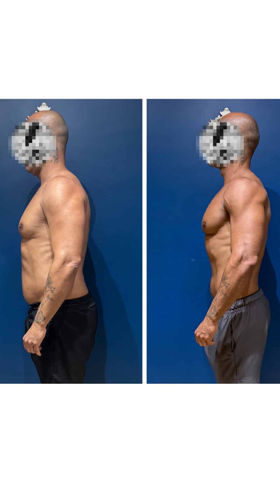 Recomposição corporal: perdeu 15% de percentual de gordura e desenvolveu massa muscular